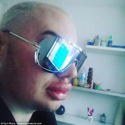奇闻录，男子突然变丑，下唇比上唇厚一倍，真相令人震惊！